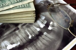 money and dental X-ray